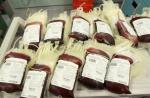 Biti donor je korisno.  Krvni vodič.  Mitovi i istina o darivanju Je li moguće darivati ​​krv nakon operacije?