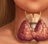 Симптомы заболеваний щитовидной железы у женщин