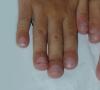 Značajke anatomije i strukture falnging prstima kod ljudi