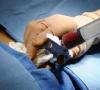 Tratament HIV cu transplant de măduvă osoasă și celule stem Transplant de măduvă osoasă în Germania