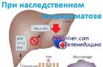 Hemokromatoza (brončani dijabetes) - uzroci, simptomi, dijagnoza i učinkovito liječenje Stoga je strogo zabranjeno