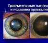 Typen en behandeling van traumatisch cataract Hoe en waarom ontwikkelt de ziekte zich