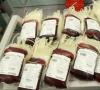 Biti donor je korisno.  Krvni vodič.  Mitovi i istina o darivanju Je li moguće darivati ​​krv nakon operacije?