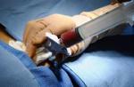 Transplantacija koštane srži i matičnih stanica u Njemačkoj. Transplantacija koštane srži u Njemačkoj.
