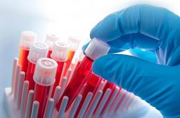 Testați pentru HIV și hepatită, de ce și cum să-l luați