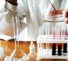 De ce se efectuează un test biochimic de sânge dintr-o venă și ce arată?
