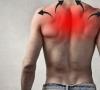Uzroci boli u gornjem dijelu leđa