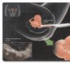 Cum se comportă după inspecția embrionului, ce se poate face după ECO: recomandări și interdicții