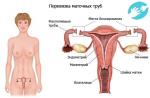 Este posibil să rămân însărcinată dacă trompele uterine sunt legate?