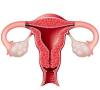 Consecințele îndepărtării uterului și a ovarelor