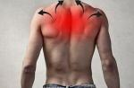 Uzroci boli u gornjem dijelu leđa