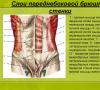 Peretele abdominal b - impunerea de suturi întrerupte pe peretele anterior al tecilor mușchilor rectus abdominis