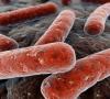 Kochov štapić: što je to i koji su uzročnici tuberkuloze?